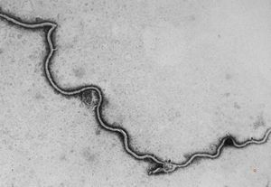 Borrelia Burgdorferi isolated from liquor